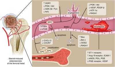 Steroid-Induced Osteonecrosis of the Femoral Head: Novel Insight Into the Roles of Bone Endothelial Cells in Pathogenesis and Treatment